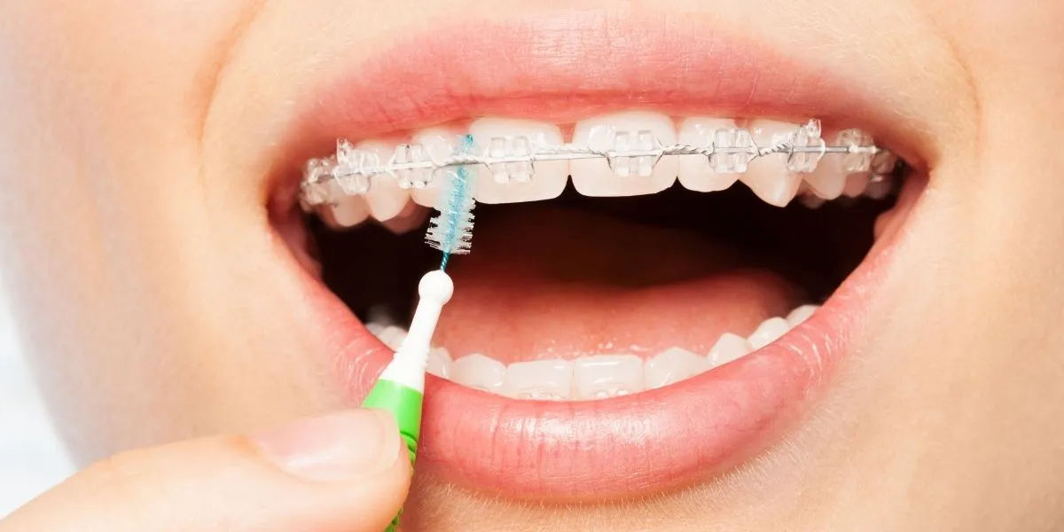 Interdental Brushes